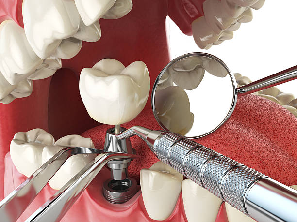Best Emergency Dentist for Special Needs Patients in Belleville, KS